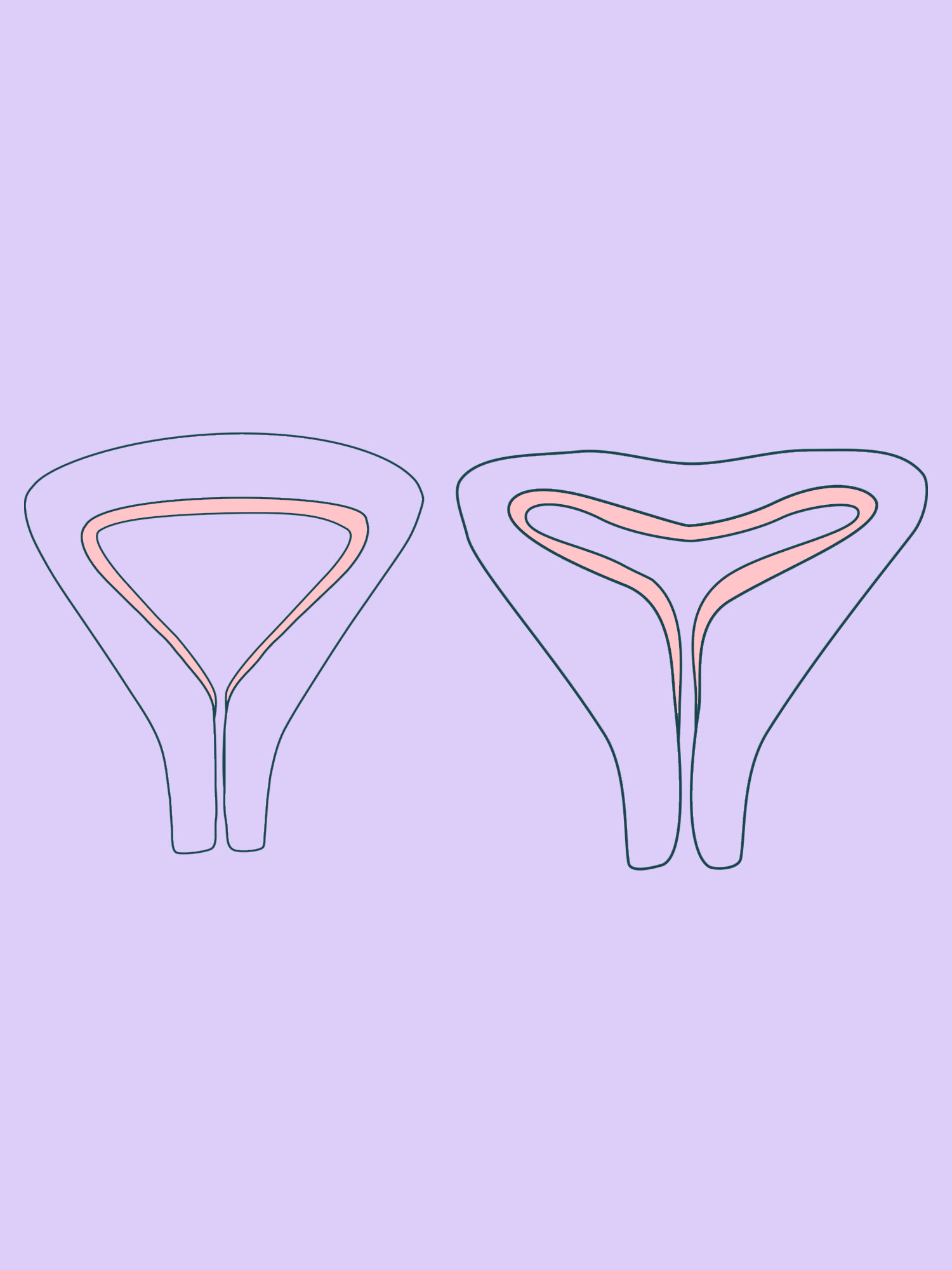 kaunuma lūpu korekcija