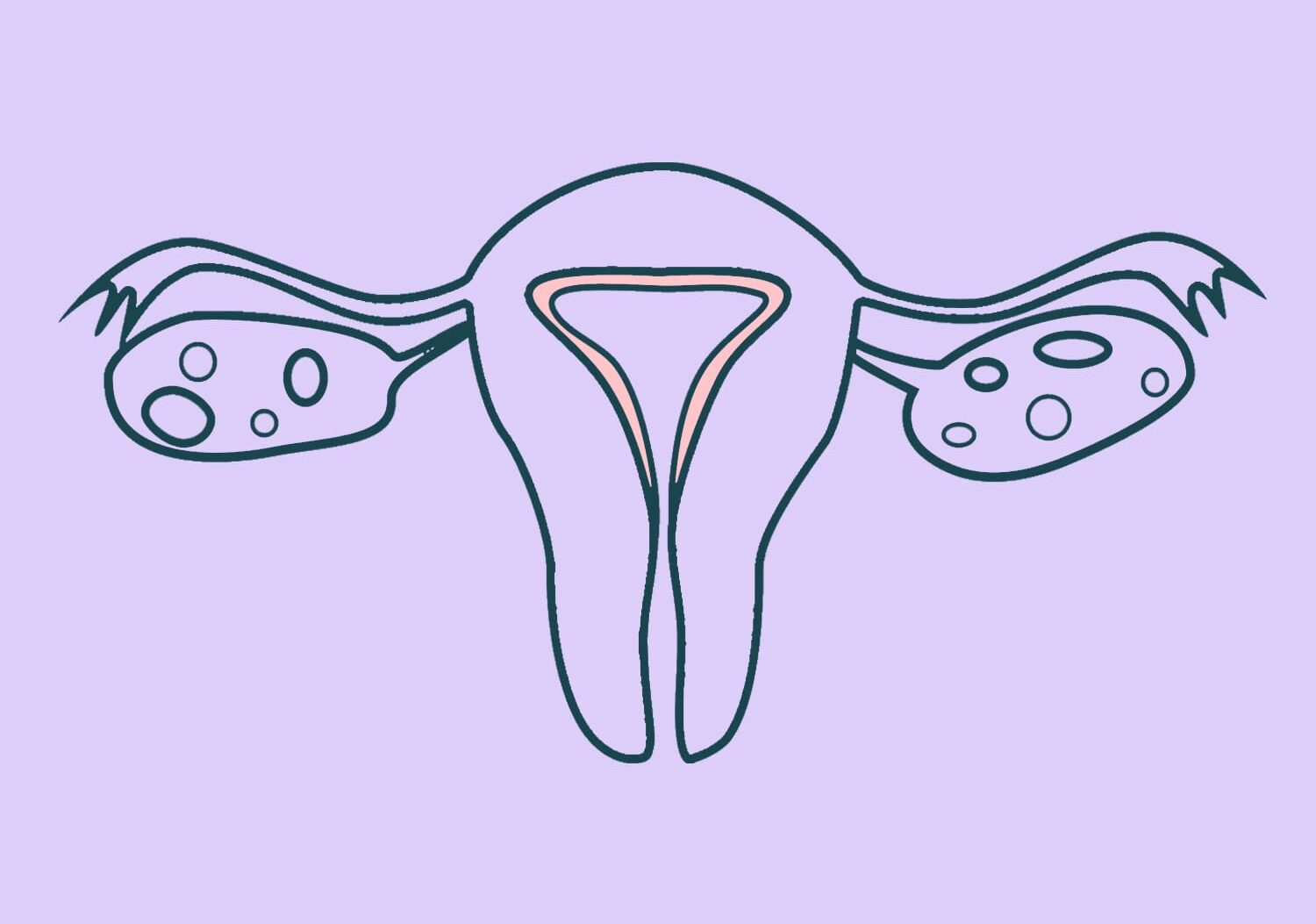 Legāls aborts
