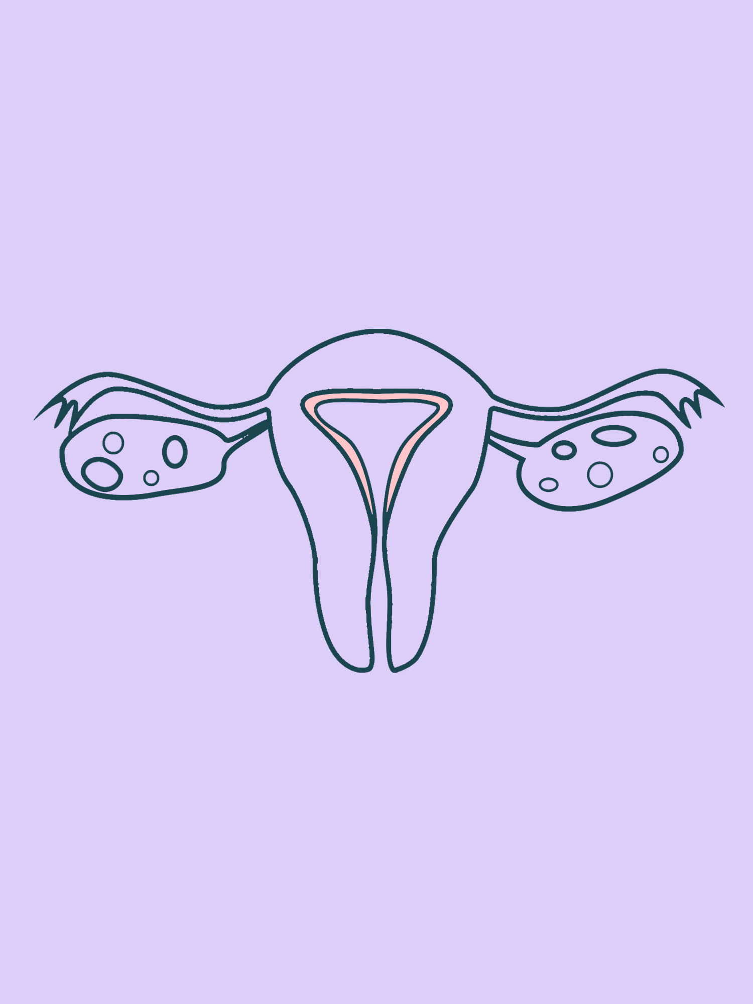 Legāls aborts