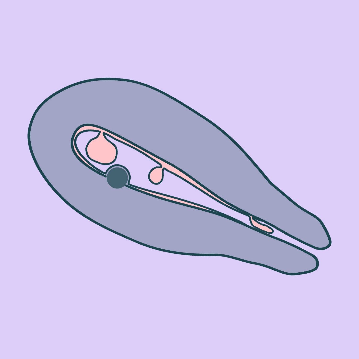 Histeroskopiska polipektomija