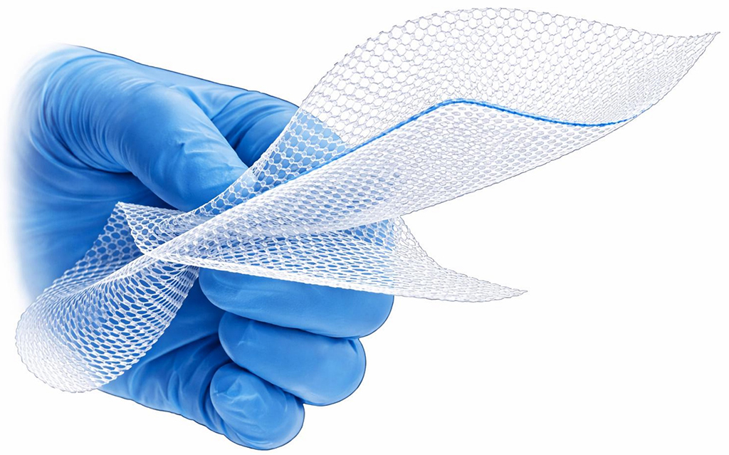 Figure 3. Synthetic mesh