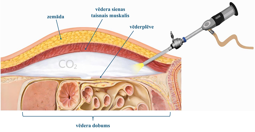 Vēdera dobums