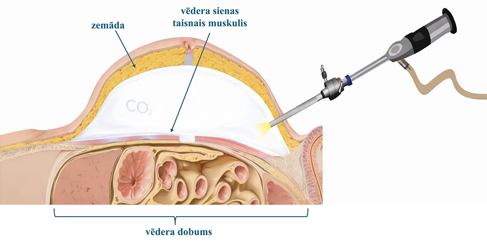 Vēdera dobums