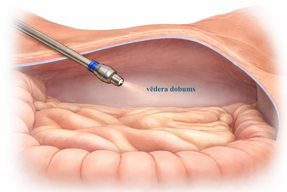 Vēdera dobums
